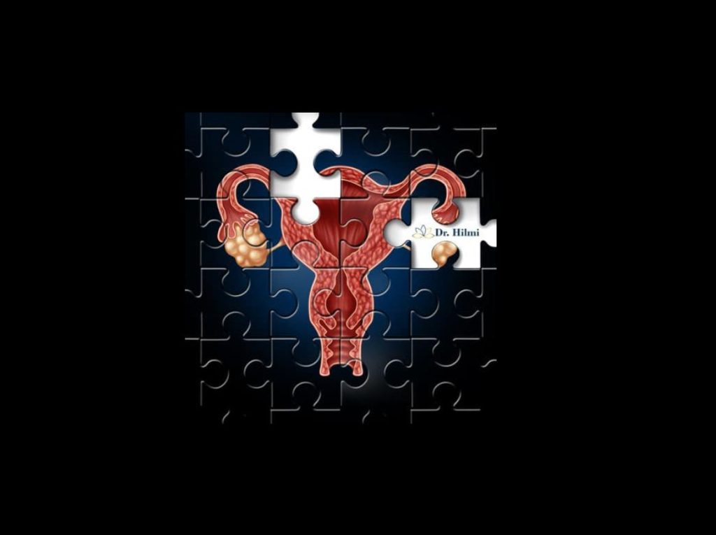 hysteroscopy, dr. hilmi fertility clinic