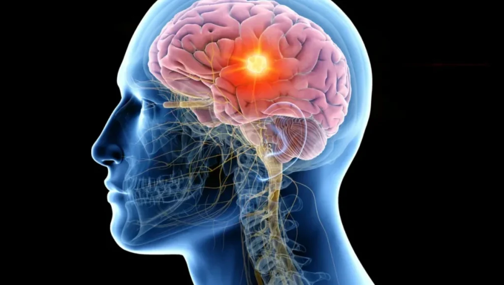 Interpretarea electroencefalogramei: Cum tehnologia ne ajută să înțelegem activitatea creierului