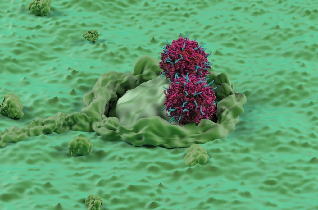 Cancerul Colorectal la Tineri: Cauze, Simptome și Screening