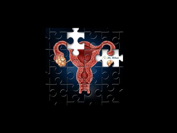 hysteroscopy, dr. hilmi fertility clinic