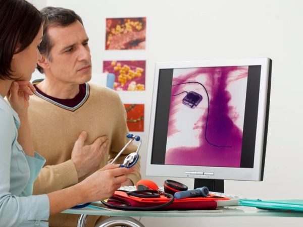 image-2023-02-17-26089481-41-stimulator-cardiac.jpg