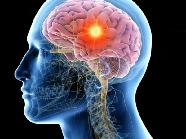 Interpretarea electroencefalogramei: Cum tehnologia ne ajută să înțelegem activitatea creierului